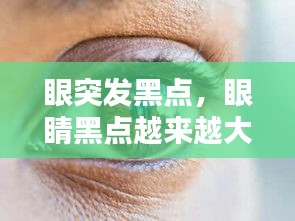 眼突發(fā)黑點(diǎn)，眼睛黑點(diǎn)越來越大 